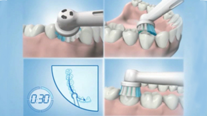 Čištění každé ze 4 zón (levé, pravé, spodní, horní).