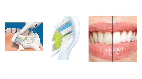 Díky sonické technologii, zubního kartáček Philips Sonicare DiamondClean odstraní až pětkrát více plaku a bělí zuby až 2x lépe než ruční zubní kartáček.