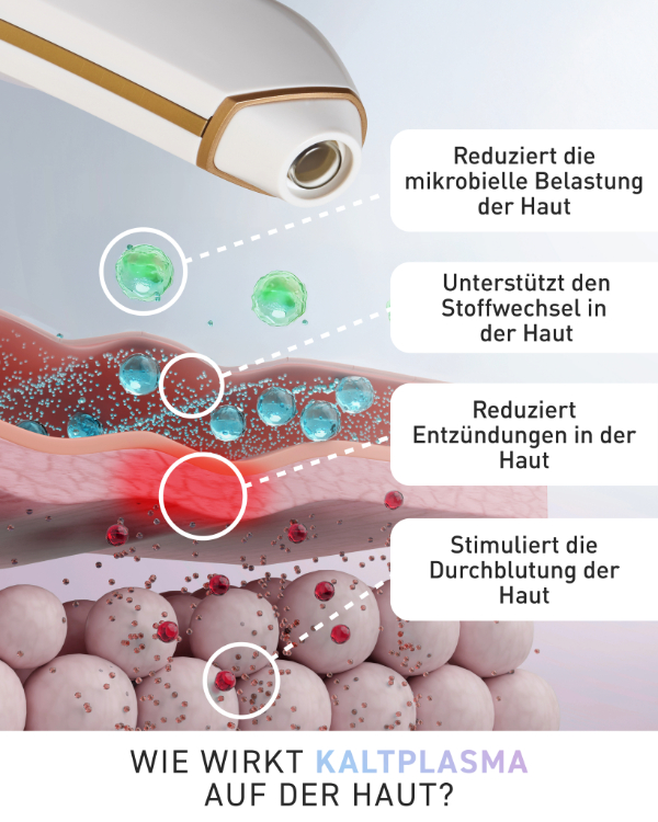 My Coldplasma bei trnd