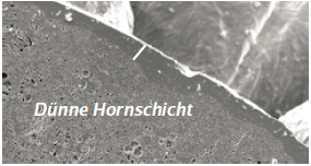 Feuchtigkeitsarme Haut