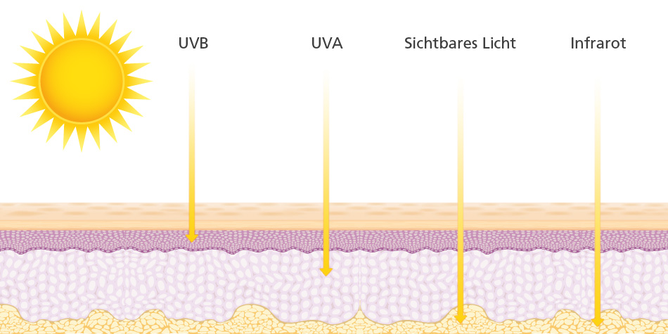 Die verschiedenen Strahlenarten des Sonnenlichts dringen tief in die Haut ein. Spezielle Filter in Sonnencremes können davor schützen.