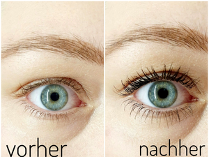 vorher-nachher
