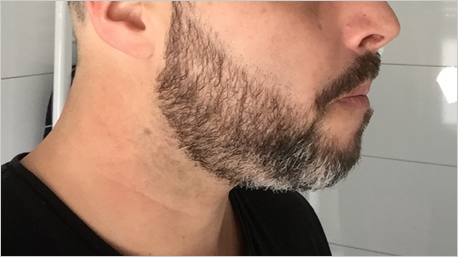 trnd-Partner schwarztrinker