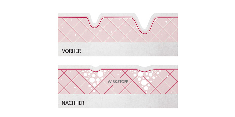 Darum ist Kollagen wichtig für die Haut