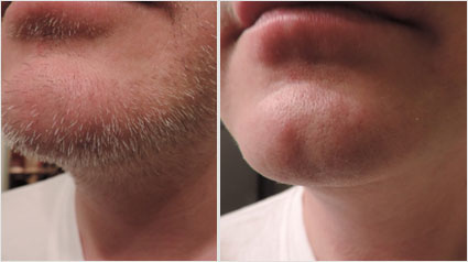 Onlinereporter Antarro