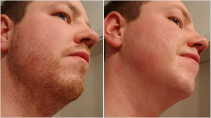 Onlinereporter Chefkoch-United