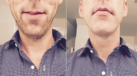 Variante 1 von trnd-Partner Plan_B