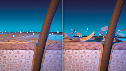 So entstehen Schuppen.