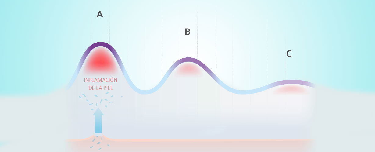Aprenderemos sobre la importancia de un cuidado completo para mantener una epidermis sana...