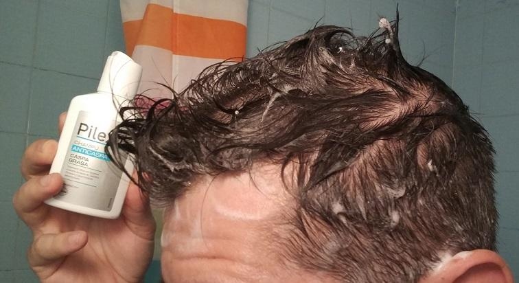 ¿Cómo va la experiencia con Pilexil Anticaspa?