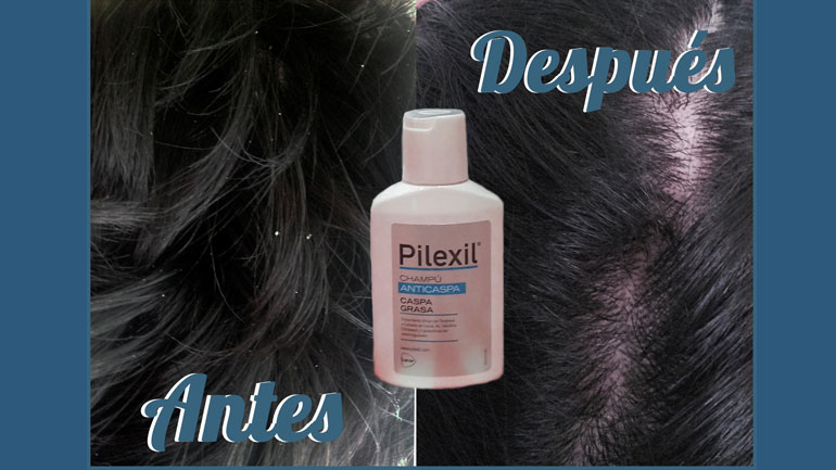 ¿Cómo está nuestro cabello?