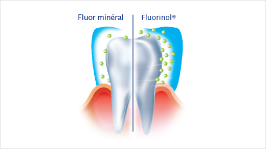 ELGYDIUM Protection Caries contient deux composants innovants pour une protection renforcée : 1. Le Fluorinol®, un fluor de haute performance qui permet de favoriser la reminéralisation et contribue à la résistance face aux attaques acides.