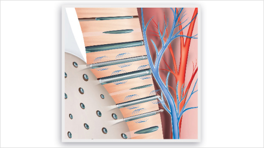 Le dentifrice Sensodyne® Soin Complet contient du Nitrate de Potassium. Il agit directement à l’intérieur de la dent et crée une protection apaisante autour du nerf pour soulager la sensibilité dentaire.