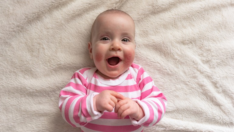 Stelatopia® Intense