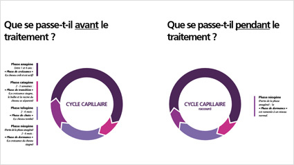 Pousse des cheveux, Croissance des cheveux, Accélérer croissance des cheveux, Chevelure dense, Traitement pour chevelure dense, Traitement pour plus de cheveux, Plus de cheveux, Cheveux fins, Volume cheveux, Perte de cheveux, Chute de cheveux, Calvitie, T