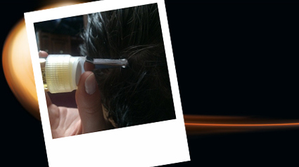 Perte de cheveux, Chute de cheveux, Traitement chute de cheveux, Cuir chevelu, soin chute cheveux, traitement capillaire, Aminexil, Aminexil pro, Pousse des cheveux, Croissance des cheveux, Chevelure dense, Traitement pour chevelure dense, Traitement pour