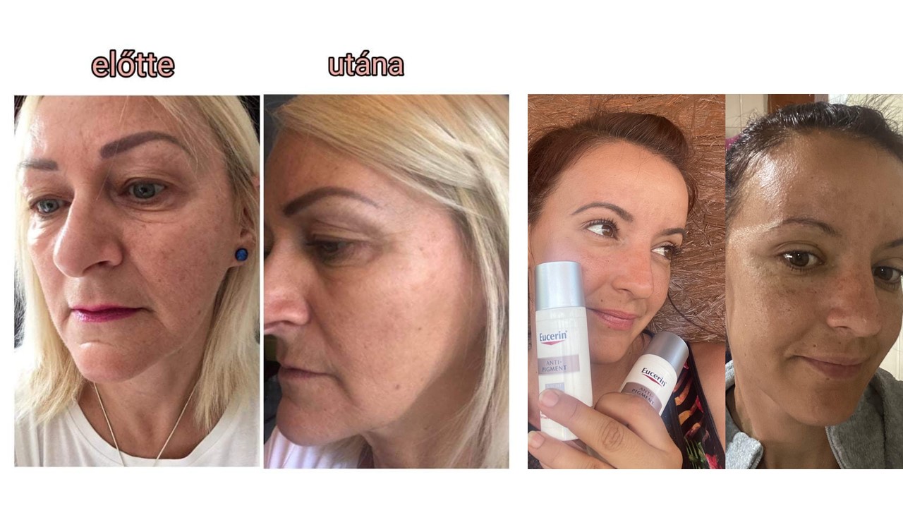 Eucerin | Anti-Pigment