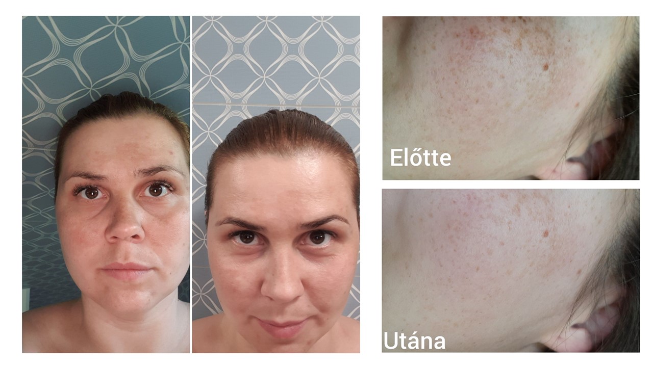  Előtte-utána képeink a tesztelés végén