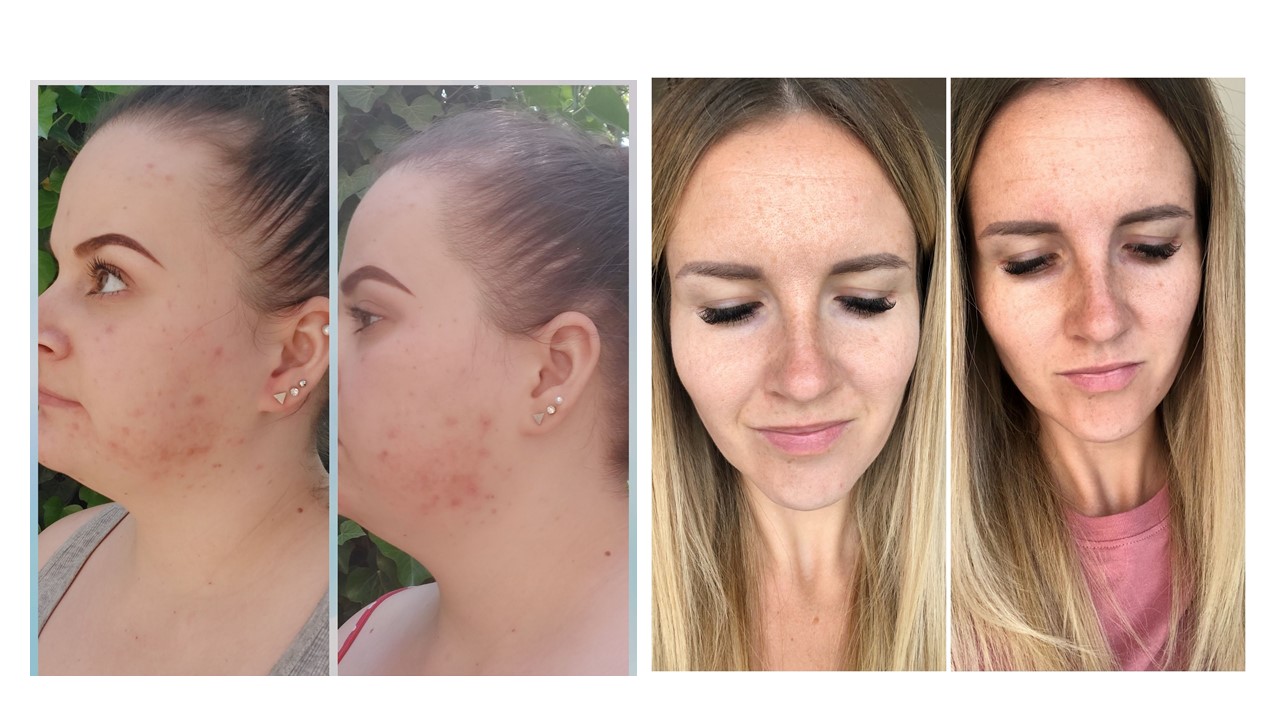  Előtte-utána képeink a tesztelés végén