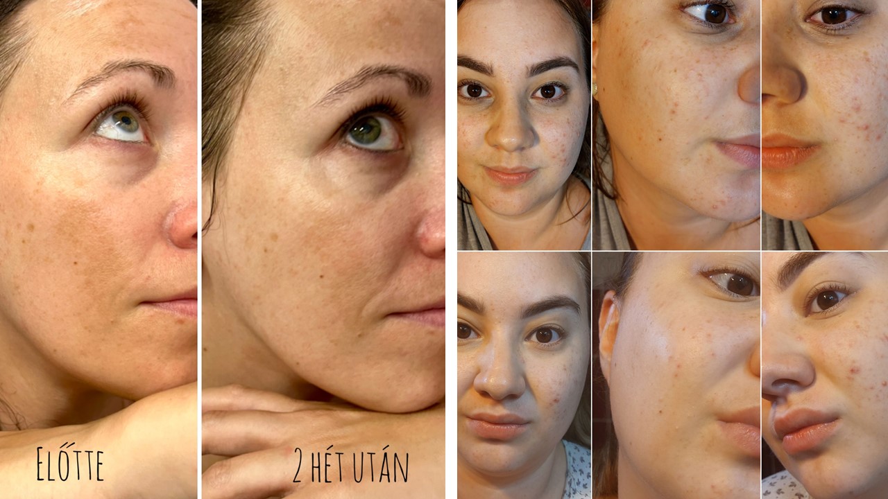  Előtte-utána képeink a tesztelés végén