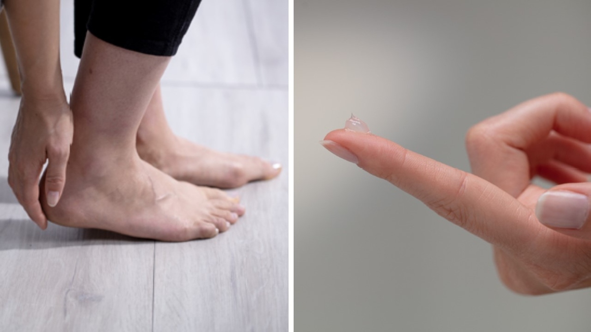 Eucerin Aquaphor és UreaRepair