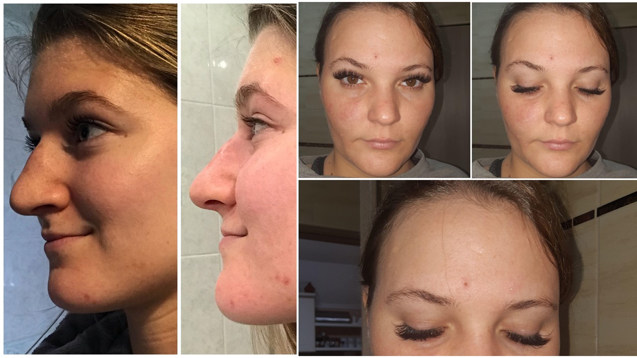  Előtte-utána eredményeink.