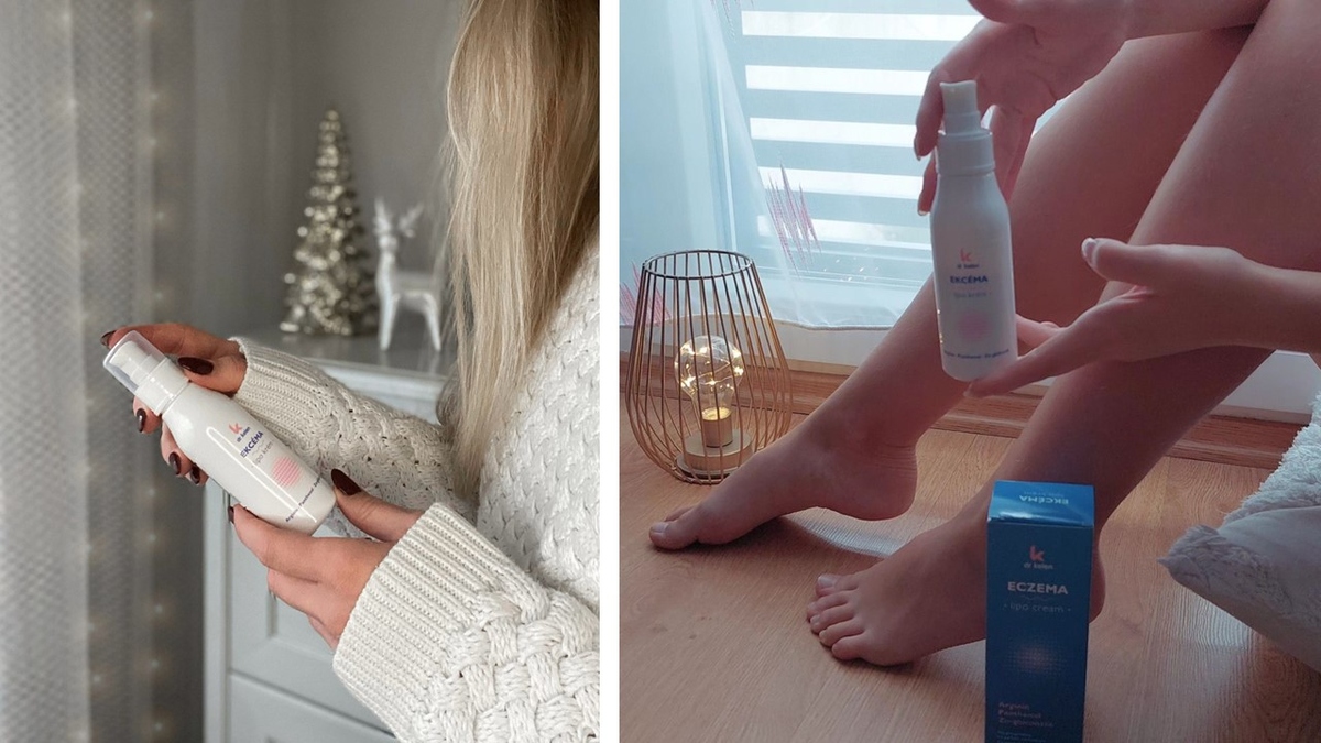 Mit mondanak barátaink a Dr.Kelen Ekcéma Lipo Krémről?