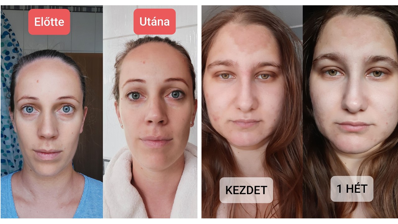  Előtte-utána képeink a tesztelés végén