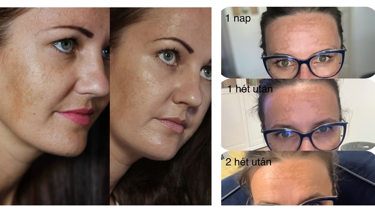  Előtte-utána képeink a tesztelés végén