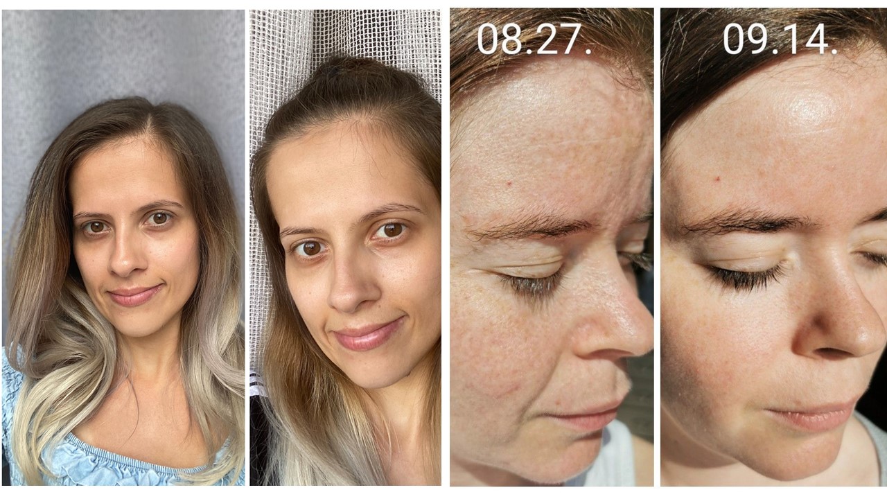  Előtte-utána képeink a tesztelés végén