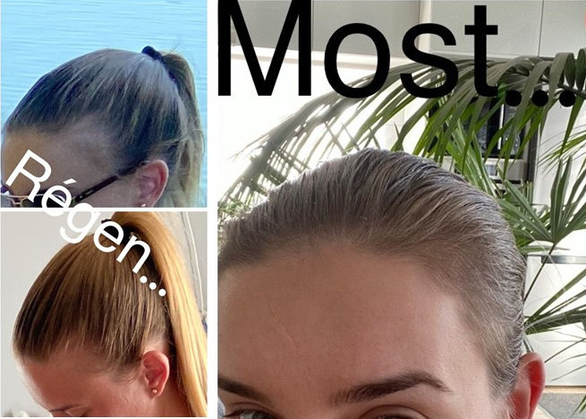 Revalid Regrowth Serum hosszú távú tapasztalatok