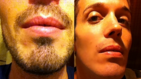 Trnder musicwalter condivide il suo prima/dopo l'utilizzo del rasoio Braun.