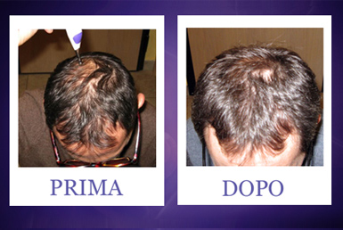 results-scorpio_pine