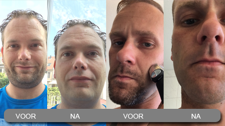 Klik op de foto om ook jouw voor en na selfies up te loaden!