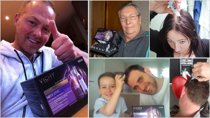 Haar groeien, Haargroei versnellen, Voller haar, Behandeling voller haar, Meer haar, Dunner haar, Behandeling voor meer haar, Haar volume, haaruitval, kaalheid, haarverlies, tegen kaalheid, behandeling haaruitval, zichtbaar hoofdhuid.