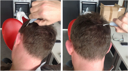 Haar groeien, Haargroei versnellen, Voller haar, Behandeling voller haar, Meer haar, Dunner haar, Behandeling voor meer haar, Haar volume, haaruitval, kaalheid, haarverlies, tegen kaalheid, behandeling haaruitval, zichtbaar hoofdhuid.