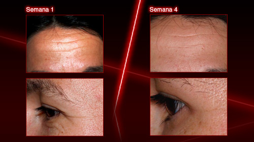 trnd_marketing_colaborativo_Revitalift_Cuidado-Dia_foto-depois